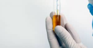 Proteinuria nel cane